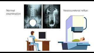 The CARE foundation  Ultrasound cystography [upl. by Donalt440]