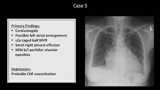 How to Interpret a Chest XRay Lesson 10  Self Assessment Part 1 [upl. by Anayet]