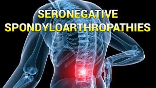 Seronegative Spondyloarthropathies updated 2023  CRASH Medical Review Series [upl. by Cardew]