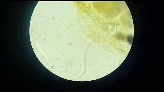 strongyloides stercoralis larvae [upl. by Chaing]