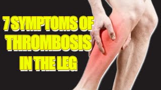 Top 7 Signs and Symptoms of Leg Blood Clots  Preventing Deep Vein Thrombosis [upl. by Nerty]