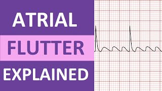 Atrial Flutter ECG Causes Treatment Nursing NCLEX ACLS Heart Rhythm Explained [upl. by Garwin]