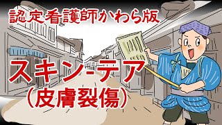 【認定看護師かわら版 必見！”てぇーへんだ！”シリーズ】スキンテアをご存知ですか？ [upl. by Elohcin705]