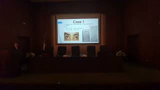 Exotropia case presentation Dr Yara Fathi [upl. by Ahs750]