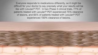 Levulan Patient Education Video [upl. by Oderfigis]