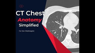 CT chest Anatomy Made simple For Medical students residents and clinicians [upl. by Reitrac]