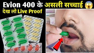 Evion 400600 और 200 के असली सच्चाई  Vitamin e Capsules For Skin  Evion 400 For Skin [upl. by Queri]