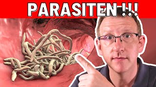 10 Frühwarnzeichen von Parasiten die sofortiges Handeln erfordern [upl. by Ezri]