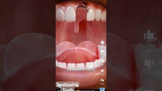 Swallowing Tooth science dentist satisfying experiment [upl. by Hasila]