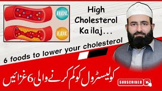 High Cholesterol ka Ilaj In UrduHindi l High CholesterolLDL Symptoms Causes and Treatment [upl. by Aeki]