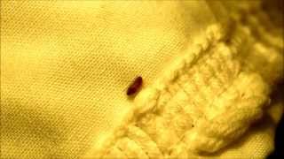 Varied Carpet Beetle Larvae Anthrenus verbasci Your Home [upl. by Vine]