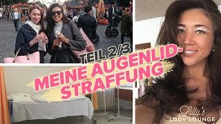 Meine AUGENLIDSTRAFFUNG FMA Teil 23 — Nach der OP [upl. by Gerstner890]