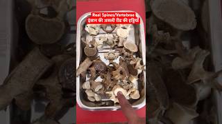 Human Real Spines  Vertebrae  रीड़ की हड्डियाँ short trending viralshorts [upl. by Verda]