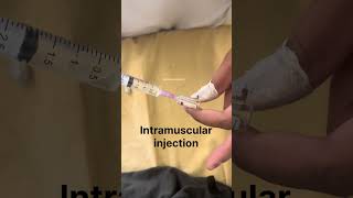 Intramuscular injection at ventrogluteal muscle in Male patient intramuscularinjection nurses [upl. by Harraf]