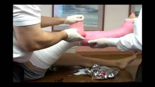 Application Long Leg Cast  Fiberglass Medical Leg Cast [upl. by Wadleigh936]