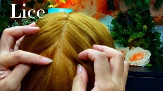 ASMR Lice Removal Pop the Lice directly on the Scalp and nails 😴💤🥱 [upl. by Adebayo]