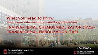 TACE and TAE transarterial chemoembolizationtransarterial embolization  Ohio State Medical Center [upl. by Netsrik]