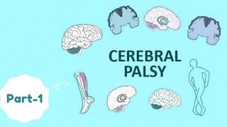 CEREBRAL PALSY  PART1  PEDIATRIC NEUROLOGY  SPASTIC ATHETOID ATAXIC TYPE OF CEREBRAL PALSY [upl. by Atlas813]