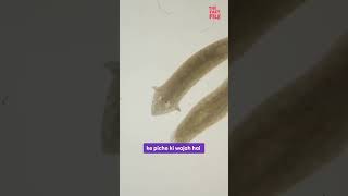 Planaria facts ytshorts worms planaria [upl. by Atnohs394]