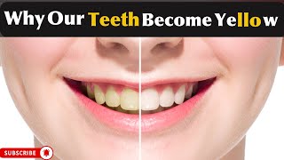 Why does our teeth turn to Yellow Yellow Teeth  Teeth yellowness and discoloration  MHCP [upl. by Eskill]