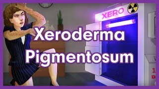 Xeroderma Pigmentosum Mnemonic for USMLE [upl. by Missi]