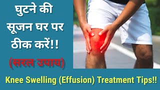 Knee Swelling  Effusion Treatment in Hindi  घुटने में सूजन का घरेलू इलाज  Knee swelling in Hindi [upl. by Oretos]