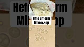 So sieht Hefe unterm Mikroskop aus wissenswert biologie natur mikrokosmos mikroskop fyp [upl. by Enerod]