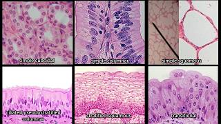 Identifying Epithelium  Review and Practice Questions [upl. by Allenaj760]