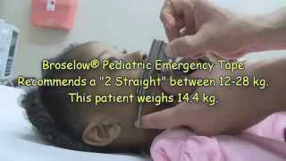 Pediatric Laryngoscope Blade Length Selection [upl. by Anemij371]