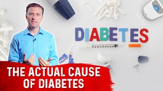 The Underlying Cause Of Diabetes – DrBerg [upl. by Procto]