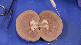 NAU Bio 202 Lab 7  Sheep Kidney Dissection [upl. by Eide]