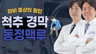 숨겨진 척추 위험 당신도 모르게 진행되는 척추 경막 동정맥루의 무서운 진실 연세산돌병원 김병우원장 김창수원장 [upl. by Atilemrac]