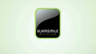 GlamSmile Porcelain Veneers [upl. by Buote]