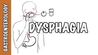 Approach to dysphagia difficulty swallowing  causes pathophysiology investigation [upl. by Eselahs]