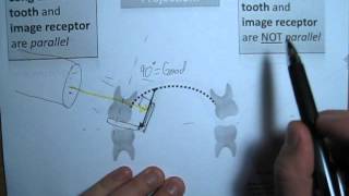 How to Bisecting angle technique VS Parallelling technique for dental imaging  dental xrays [upl. by Aleak292]