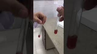 cholesterol detection test salkowski test [upl. by Bhayani]