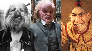 10 SIDESHOW FREAKS That REALLY EXISTED A 4Legged Woman THE ELEPHANT MAN [upl. by Carlyn]