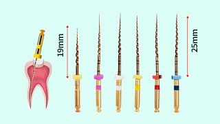 Endodontics Clinical  Rotary Instrumentation Files [upl. by Nnyleuqcaj]