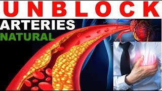 Reversing Atherosclerosis Naturally Herbal Cure How To Reverse Reduce Plaque Buildup In Arteries [upl. by Lunseth]