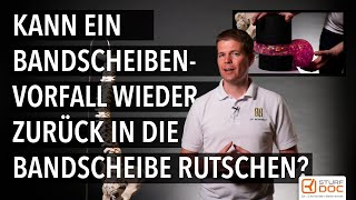 Kann ein Bandscheibenvorfall wieder zurück in die Bandscheibe rutschen  In drei Minuten erklärt [upl. by Luht]