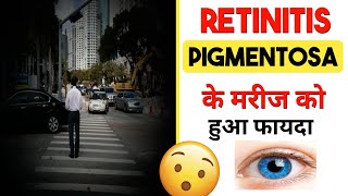 Retinitis Pigmentosa के मरीज को हुआ फायदाRP Treatment in HomoeopathyRetinitis Pigmentosa Symptoms [upl. by Yraccaz]