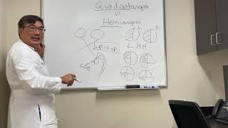 Quadrantanopia vs hemianopia [upl. by Icnan]