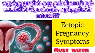 Ectopic pregnancy symptoms full explain in Tamilafter missed periods to start ectopicpregnancy [upl. by Pressey998]