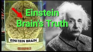 The Shocking Truth About Albert Einsteins Brain  alberteinstein informationstation18 genius [upl. by Laehcar]