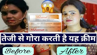 Melamet Cream  Gora karne wali cream skin whitening cream 7 day skin whitening challenge 😱😱 [upl. by Stedt]