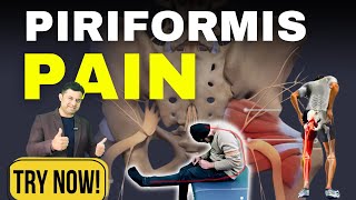 Top 3 Exercises for Piriformis Syndrome Pain Relief MUST TRY [upl. by Dew]