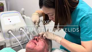 TIXEL  SKINCARE LASER CLINIC  POINT COOK MELBOURNE [upl. by Dlanar]