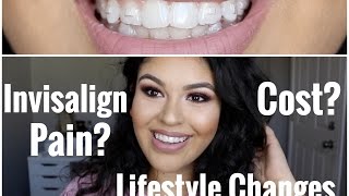 INVISALIGN  Cost Pain amp Lifestyle Changes [upl. by Silera]