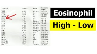 EOSINOPHIL COUNT  CAUSES OF HIGH and LOW LEVELS [upl. by Akinahs]