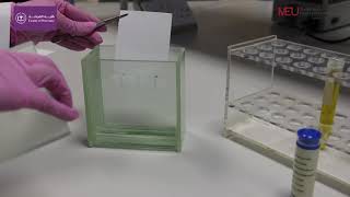 Biochemistry Lab  Thin layer chromatography for separation and identification of lipids [upl. by Analad748]